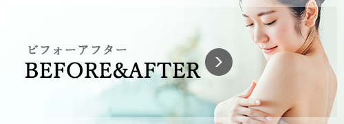 BEFORE＆AFTER